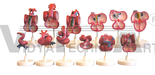 The model of heart development (one set of 12pcs)